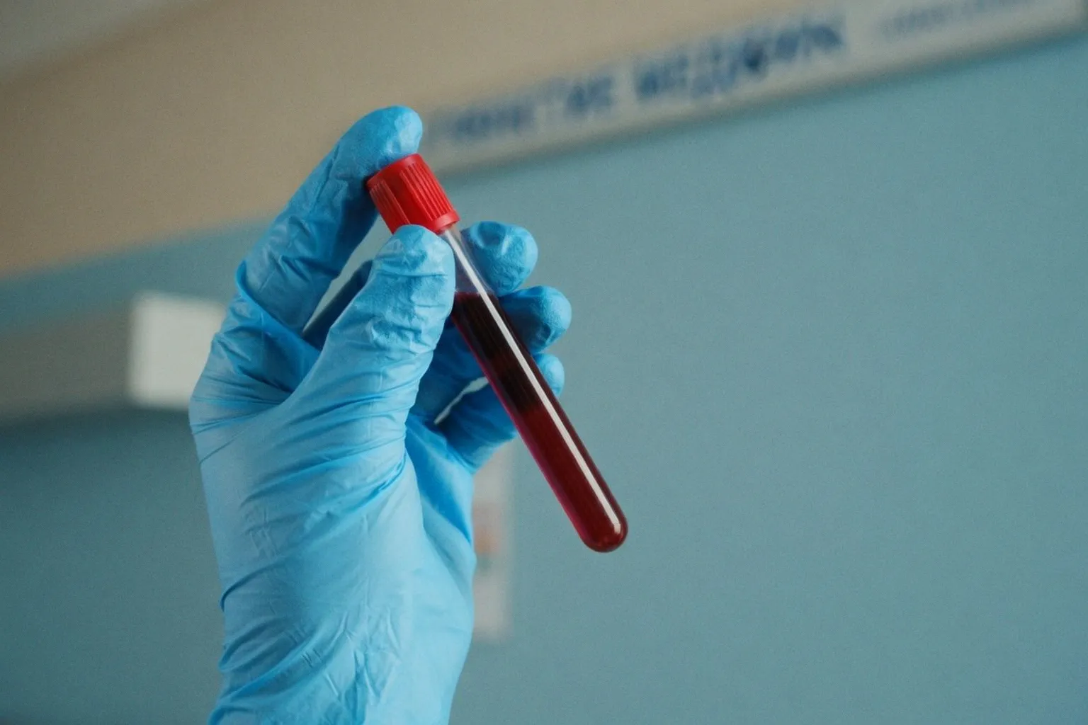 Новые стандарты скрининга ИППП: как обновленные протоколы CDC меняют превентивную медицину
